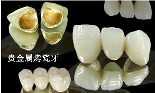 麦芽烤瓷牙
