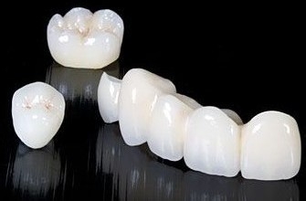 深圳烤瓷牙多少钱一颗