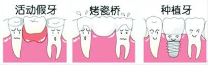 苏州美奥口腔种植牙