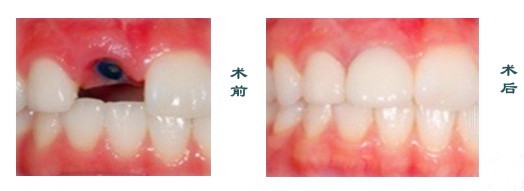 苏州美奥口腔补牙