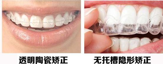 隐形矫正注意事项
