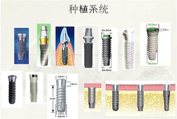 深圳种植牙一般多少钱