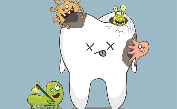 蛀牙要及时治疗