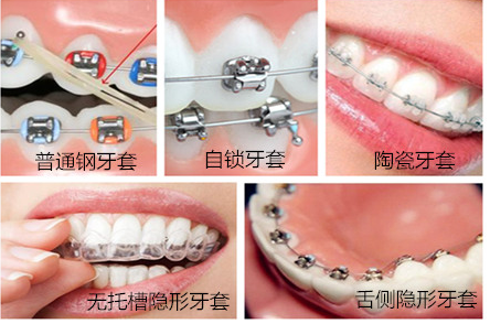 QQ截图20171115112104.png