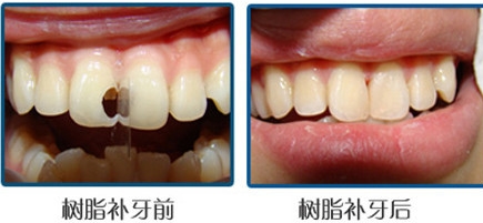 4-1FQ1104A2158_看图王.jpg